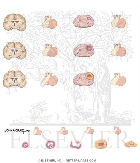 Watermarked preview of unlabeled image: Neuroendocrine regulation of Menstrual Cycle
Irregular Menstrual Periods