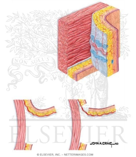 Watermarked preview of unlabeled image: Skin Flaps Based on Direct Cutaneous Arterial Supply