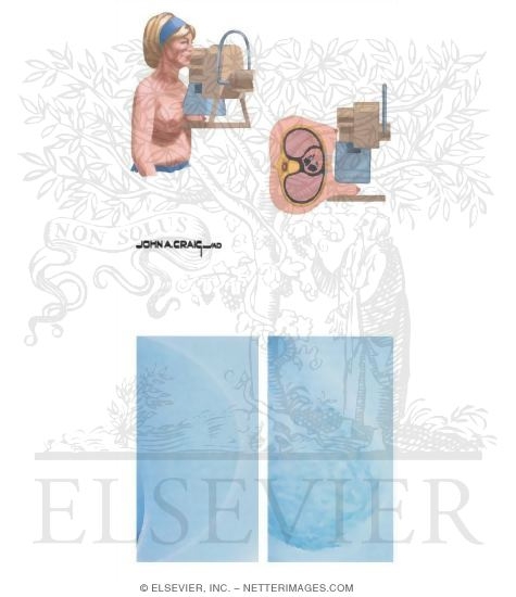Watermarked preview of unlabeled image: Mammography