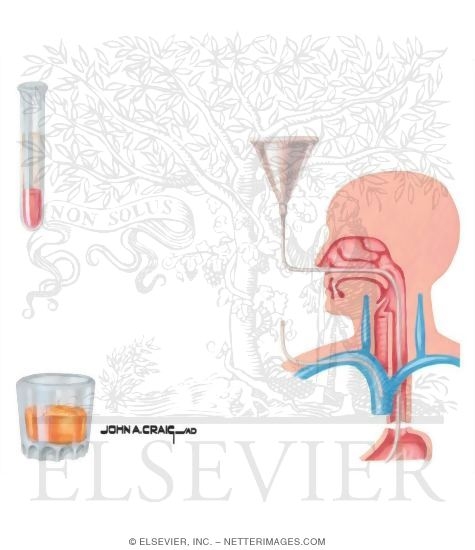Watermarked preview of unlabeled image: Local Wound Care
