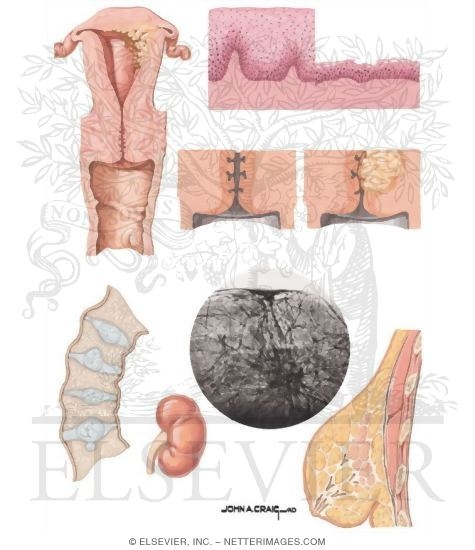 Target Organ Changes in Menopause