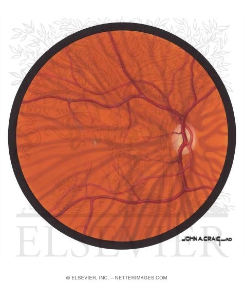 Fundus