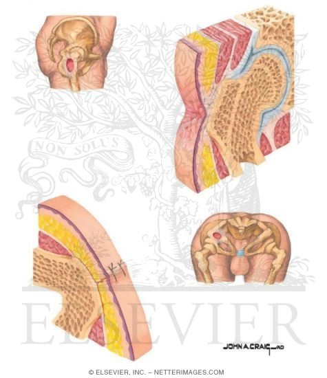 Watermarked preview of unlabeled image: Methods of Closure