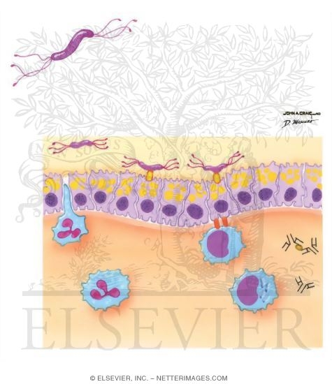 Etiology and Pathogenesis of Helicobacter Pylori
