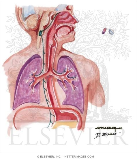 Watermarked preview of unlabeled image: Causes of Chronic Cough