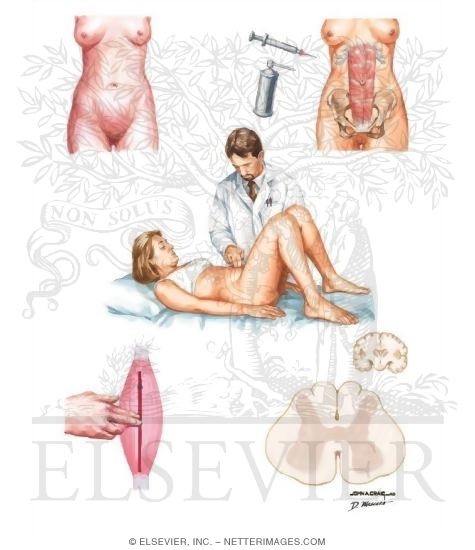 Watermarked preview of unlabeled image: Myofascial Syndromes
