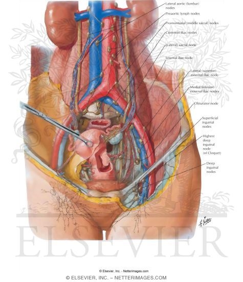 Lymph Vessels and Nodes of Pelvis and Genitalia: Female
Lymphatic Drainage II - Internal Genitalia