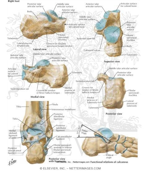 Tuberosity Of Calcaneus Calcaneal Stress Fracture Broken Heel Bone 