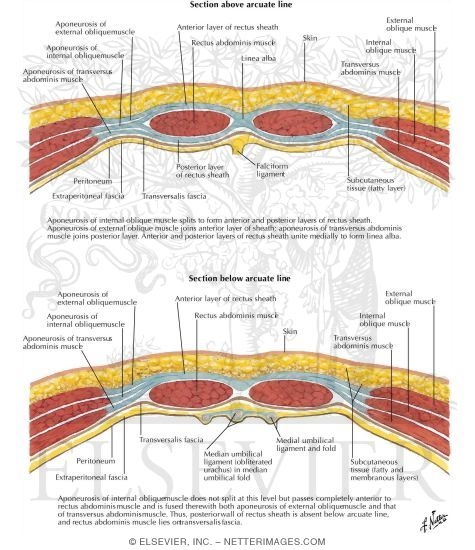 Rectus Sheath: Cross Sections 
