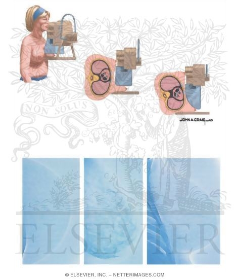Watermarked preview of unlabeled image: Mammography