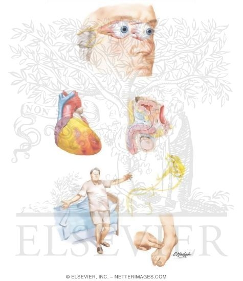 Eyeball: Musculature
Heart
Male Urogenital System: Cross Section
Orthostatic Hypotension: Man Falling
Nerve
Pedal Pulse