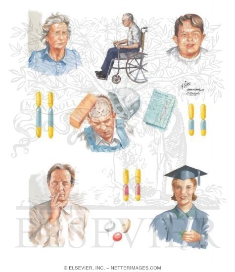 Watermarked preview of unlabeled image: Risk Factors for Alzheimer's Disease