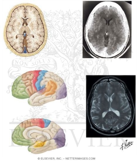 Functional Correlations and Visualization of Brain Structures