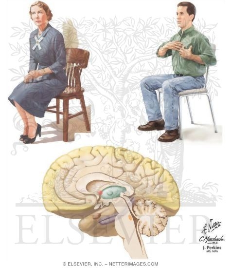 Watermarked preview of unlabeled image: Clinical Anxiety