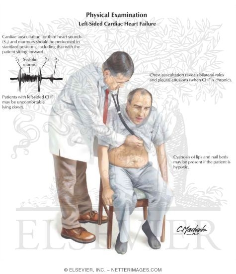 Watermarked preview of labeled image: Physical Examination: Left-Sided Cardiac Heart Failure