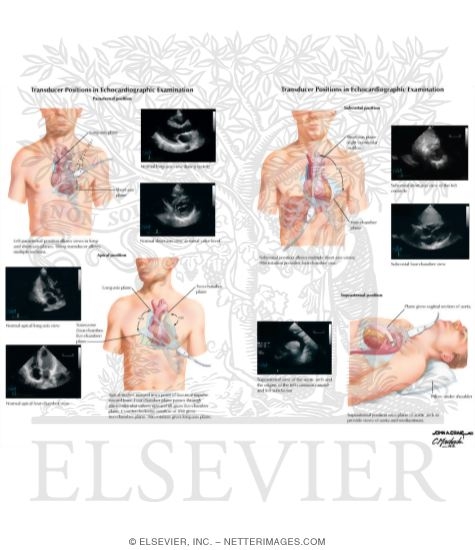 Transducer Positions in Echocardiographic Examination