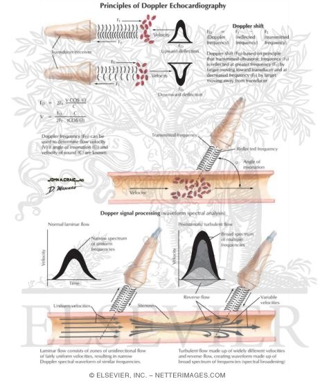 Watermarked preview of labeled image: Principles of Doppler Echocardiography