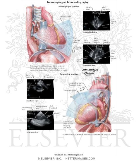 Transesophageal Echocardiography