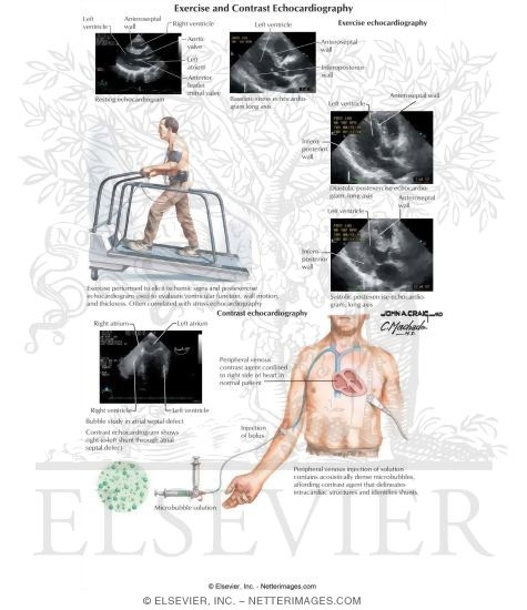 Watermarked preview of labeled image: Exercise and Contrast Echocardiography
