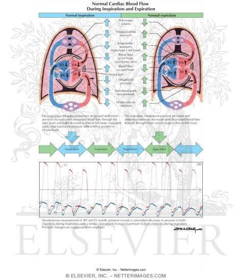 Normal Cardiac Blood Flow During Inspiration and Expiration