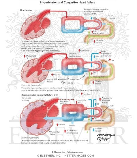 Hypertension and Congestive Heart Failure