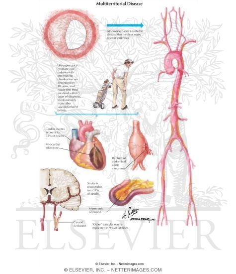 Watermarked preview of labeled image: Multiterritorial Disease