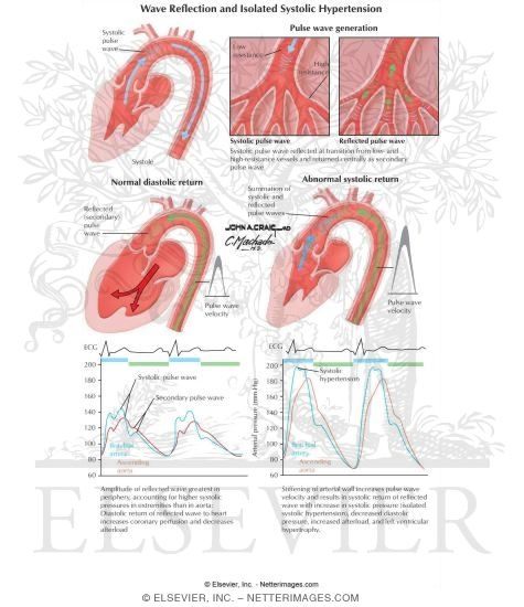 systolic hypertension