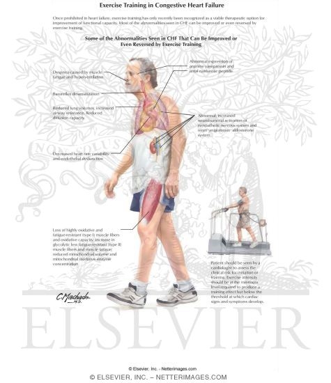Exercise Training in Congestive Heart Failure