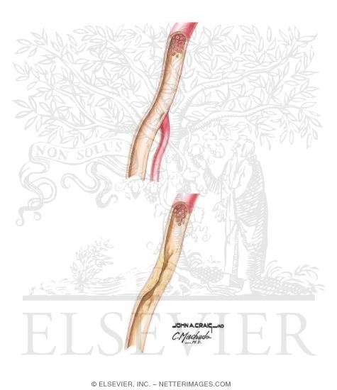 Watermarked preview of unlabeled image: Types of Arterial Noninvasive Tests