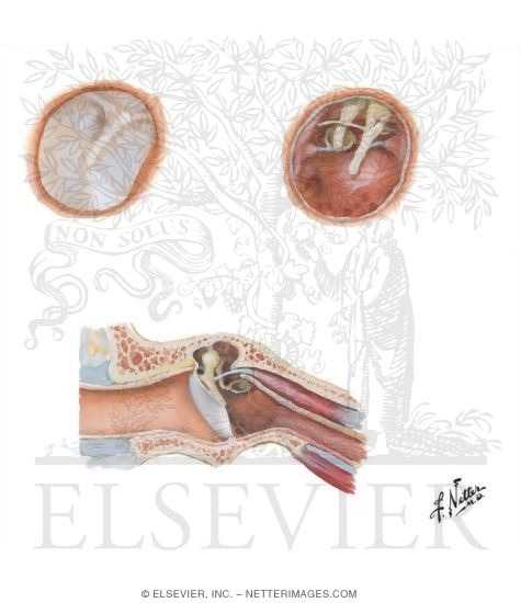 Watermarked preview of unlabeled image: External Ear and Tympanic Cavity