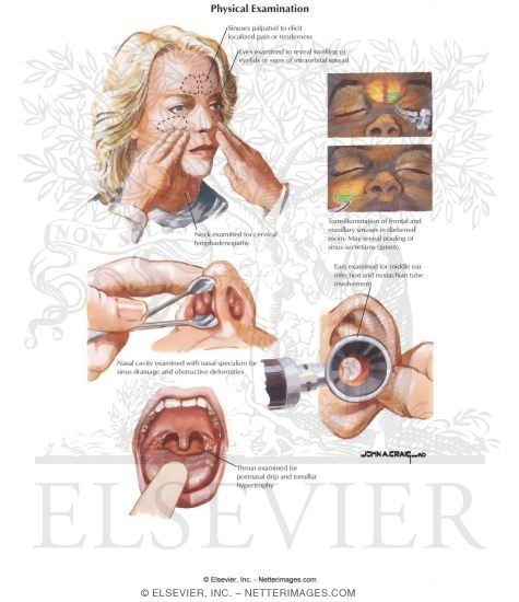Physical Examination of the Nasal Cavity
