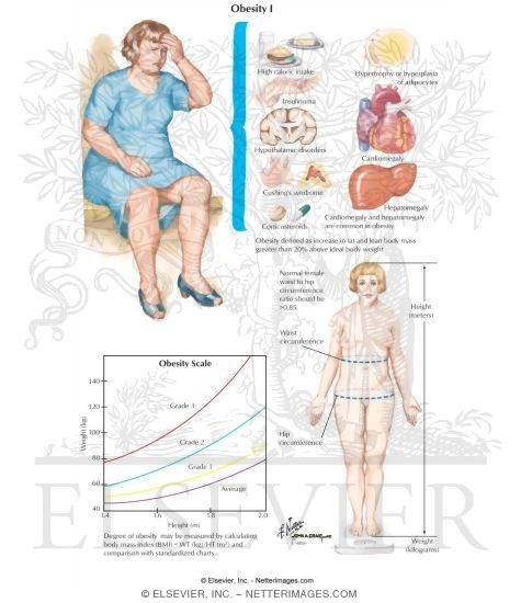 Watermarked preview of labeled image: Obesity