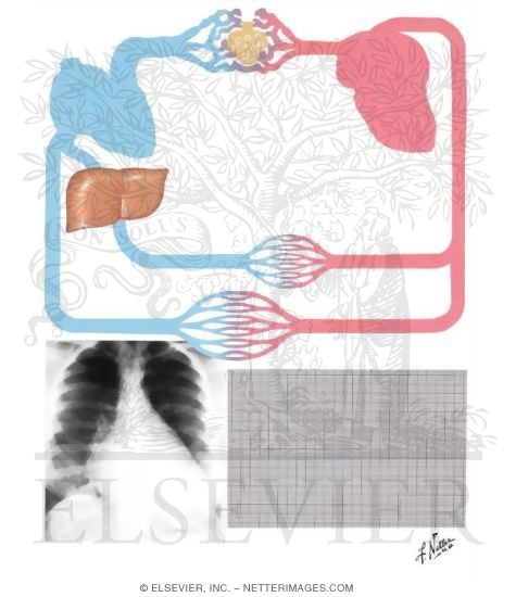 Mitral Insufficiency
Pathophysiology and Clinical Aspects of Mitral Regurgitation
Valvular Stenosis and Insufficiency