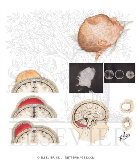 Action of Drugs on Nerve Excitability