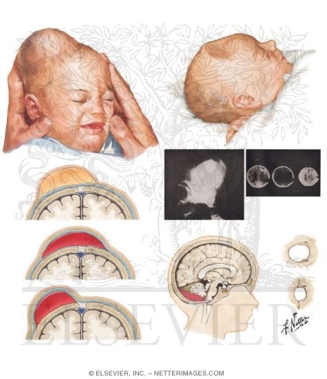 Action of Drugs On Nerve Excitability
