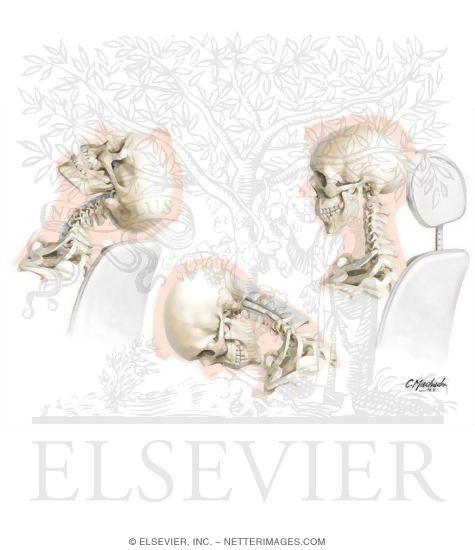 Watermarked preview of unlabeled image: Whiplash