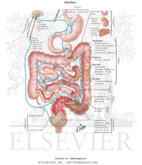 Watermarked preview of labeled image: Diarrhea