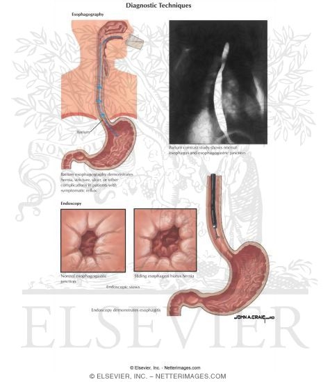 Watermarked preview of labeled image: Diagnostic Techniques