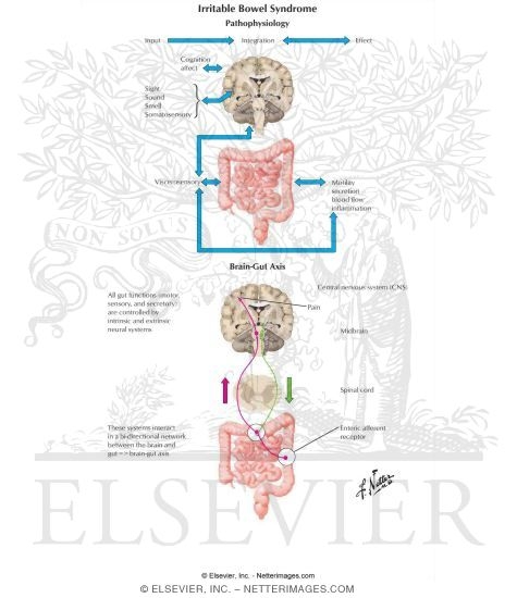 Irritable Bowel Syndrome - Pathology