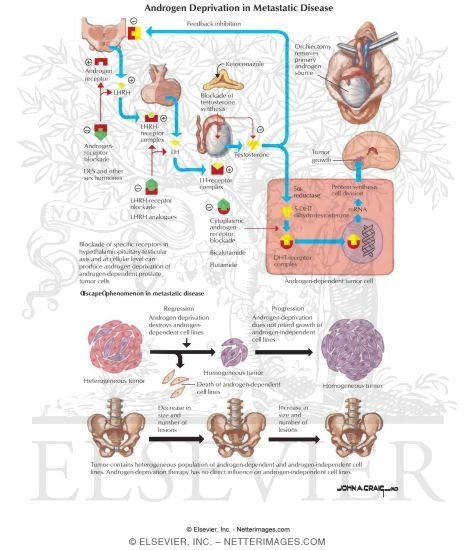 Watermarked preview of labeled image: Androgen Deprivation in Metastatic Disease