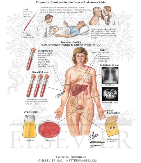 Watermarked preview of labeled image: Diagnostic Considerations In Fever of Unknown Origin