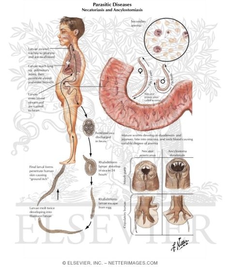 Parasitic Diseases V - Necatoriasis and Ancylostomiasis
