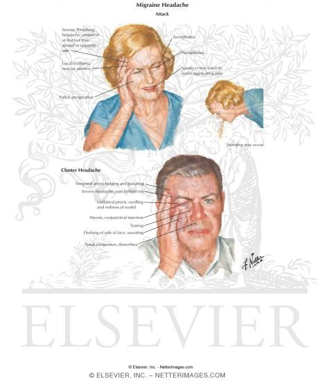 Watermarked preview of labeled image: Migraine Headaches
