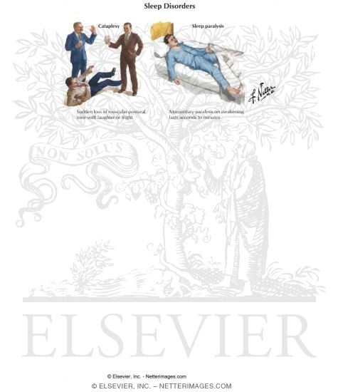 Watermarked preview of labeled image: Sleep Disorders