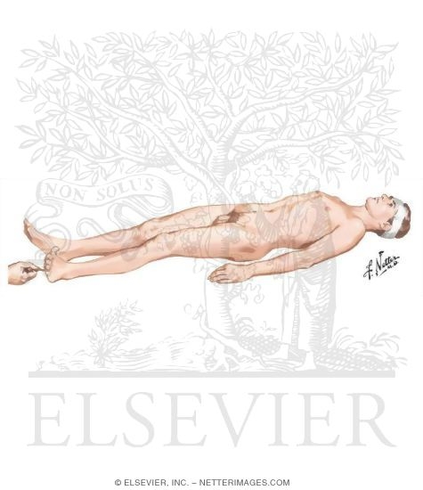 Elicitation of the Babinski Sign