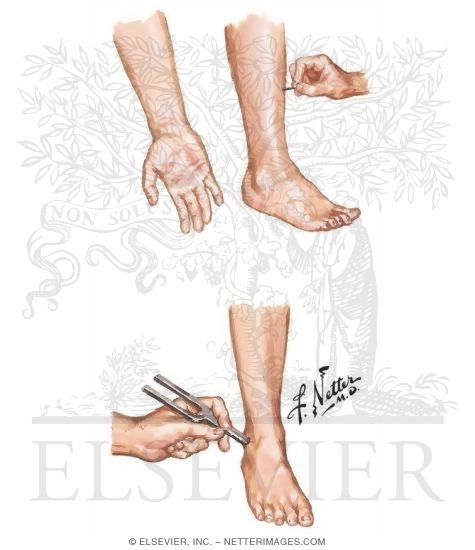 Watermarked preview of unlabeled image: Documentation of Various Types of Sensory Modalities In a Peripheral Neuropathy