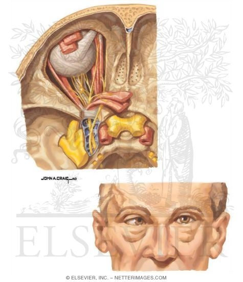 Watermarked preview of unlabeled image: Ocular Complications of Diabetes