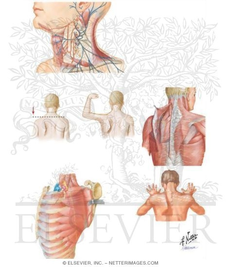 Clinical Findings In Cranial Nerve XI Damage