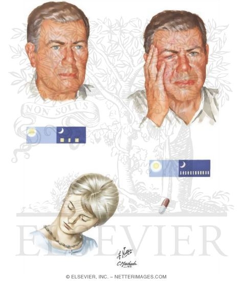 Cluster Headache and Chronic Paroxysmal Hernicrania