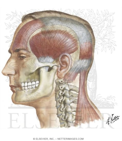 Watermarked preview of unlabeled image: Local Trigger Factors of Muscle Contraction Headache